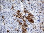 TFF1 Antibody in Immunohistochemistry (Paraffin) (IHC (P))