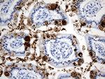 TFF1 Antibody in Immunohistochemistry (Paraffin) (IHC (P))