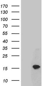 TFF1 Antibody in Western Blot (WB)