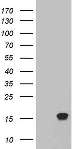 TFF1 Antibody in Western Blot (WB)