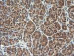 TFG Antibody in Immunohistochemistry (Paraffin) (IHC (P))