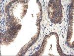 TFG Antibody in Immunohistochemistry (Paraffin) (IHC (P))