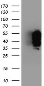 TFG Antibody in Western Blot (WB)