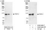 TFIP11 Antibody in Western Blot (WB)