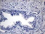 TG Antibody in Immunohistochemistry (Paraffin) (IHC (P))