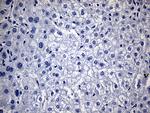 TG Antibody in Immunohistochemistry (Paraffin) (IHC (P))