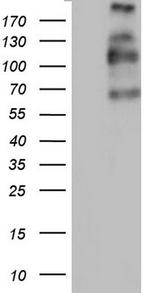 TG Antibody in Western Blot (WB)