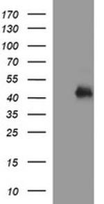 TGFB1 Antibody in Western Blot (WB)