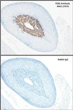 TGR5 Antibody in Immunohistochemistry (IHC)