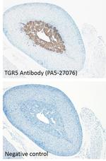 TGR5 Antibody in Immunohistochemistry (IHC)