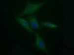 TH Antibody in Immunocytochemistry (ICC/IF)