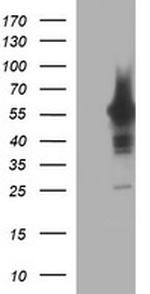 TH Antibody in Western Blot (WB)