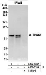 THOC1 Antibody in Western Blot (WB)