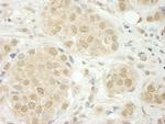 THOC5 Antibody in Immunohistochemistry (IHC)