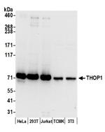 THOP1 Antibody in Western Blot (WB)