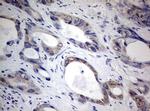 TIA1 Antibody in Immunohistochemistry (Paraffin) (IHC (P))