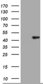 TIA1 Antibody in Western Blot (WB)