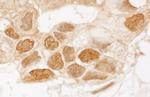 TIGAR Antibody in Immunohistochemistry (IHC)