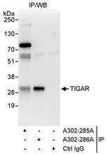 TIGAR Antibody in Immunoprecipitation (IP)