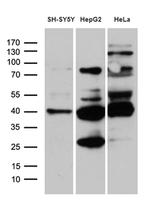 TIMM50 Antibody in Western Blot (WB)