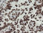 TLE1 Antibody in Immunohistochemistry (Paraffin) (IHC (P))