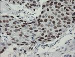 TLE1 Antibody in Immunohistochemistry (Paraffin) (IHC (P))