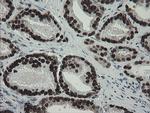 TLE1 Antibody in Immunohistochemistry (Paraffin) (IHC (P))