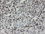 TLE1 Antibody in Immunohistochemistry (Paraffin) (IHC (P))