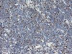 TLE1 Antibody in Immunohistochemistry (Paraffin) (IHC (P))