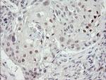 TLE1 Antibody in Immunohistochemistry (Paraffin) (IHC (P))