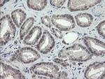 TLE1 Antibody in Immunohistochemistry (Paraffin) (IHC (P))