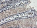 TLE1 Antibody in Immunohistochemistry (Paraffin) (IHC (P))