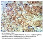 TLR13 Antibody in Immunohistochemistry (IHC)