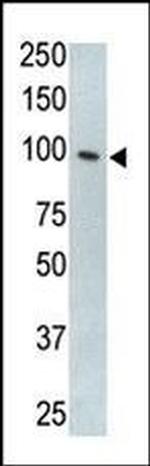 TLR5 Antibody in Western Blot (WB)