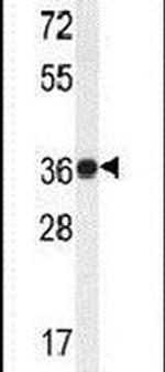 TMBIM4 Antibody in Western Blot (WB)