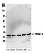 TMED10/TMP21 Antibody in Western Blot (WB)
