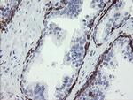 TMEM173 Antibody in Immunohistochemistry (Paraffin) (IHC (P))