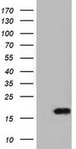 TMEM80 Antibody in Western Blot (WB)