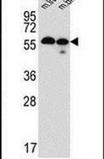 TMEM87B Antibody in Western Blot (WB)