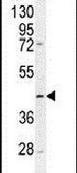 TMLHE Antibody in Western Blot (WB)