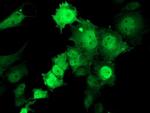 TMOD1 Antibody in Immunocytochemistry (ICC/IF)