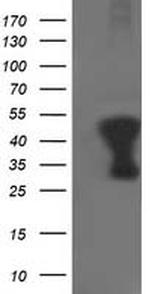 TMOD1 Antibody in Western Blot (WB)