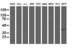 TMOD1 Antibody in Western Blot (WB)