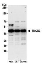 TMOD3 Antibody in Western Blot (WB)