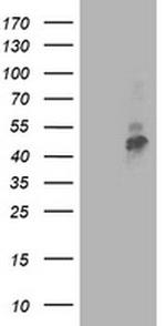 TMPRSS5 Antibody in Western Blot (WB)