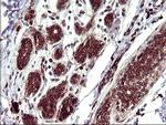 TMX1 Antibody in Immunohistochemistry (Paraffin) (IHC (P))