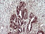 TMX1 Antibody in Immunohistochemistry (Paraffin) (IHC (P))