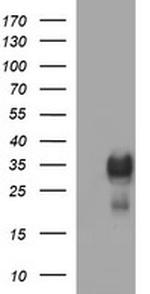 TMX1 Antibody in Western Blot (WB)