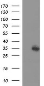 TMX1 Antibody in Western Blot (WB)