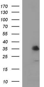 TMX1 Antibody in Western Blot (WB)